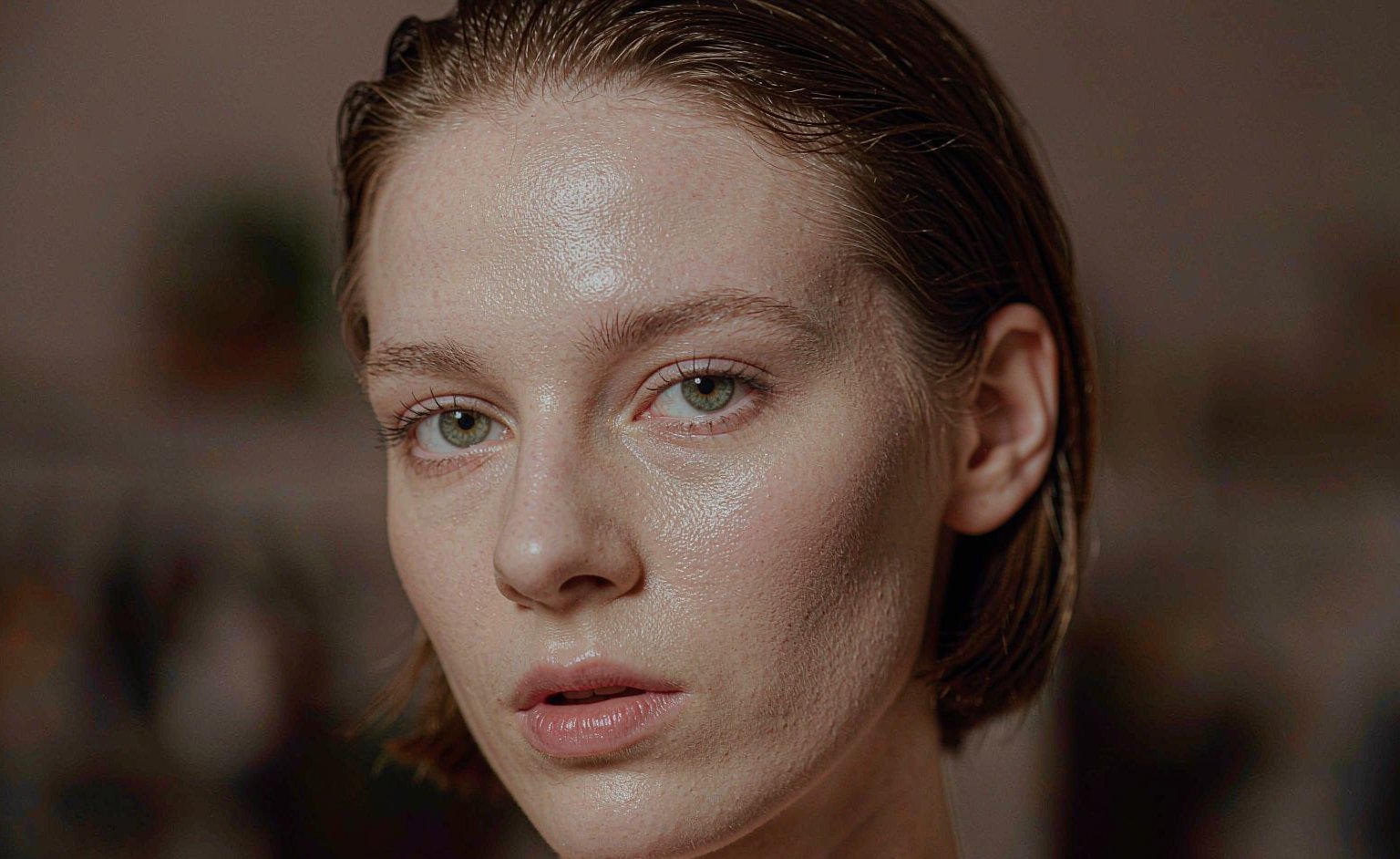 Acne Scars