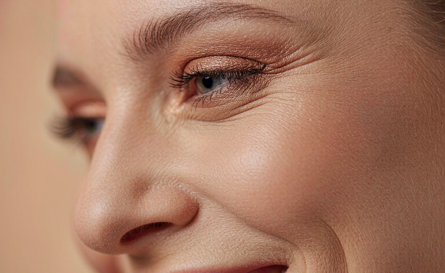 Fine expression lines around the eye area